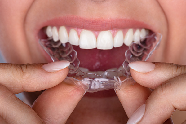 Clear aligners