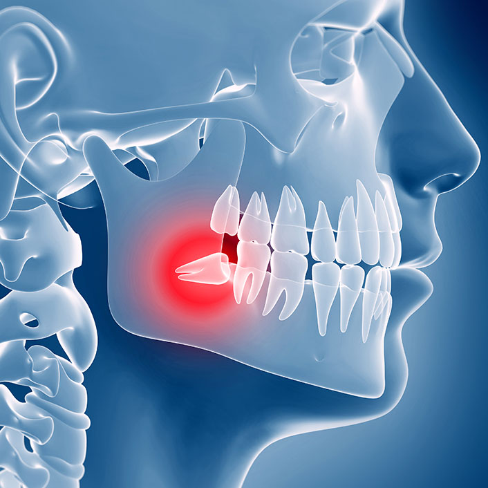 TMJ Treatments - Detail